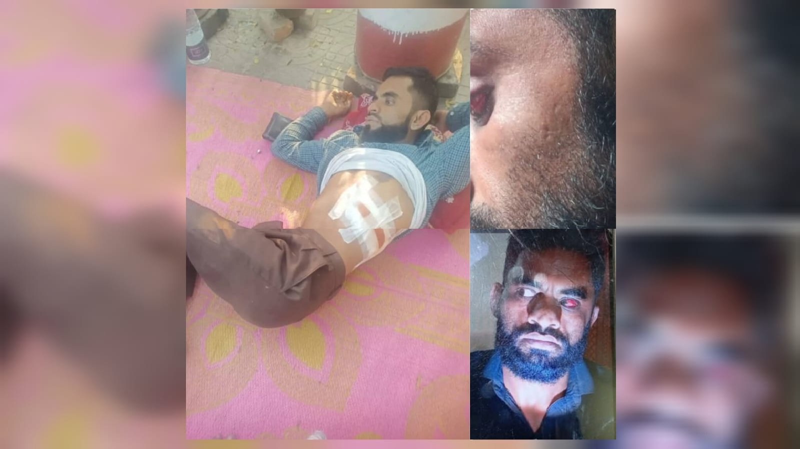 চাঁদা না পেয়ে হা/ম/লা-চিকিৎসাধীন অবস্থায় বাড়িতে লুটপাটের অভিযোগ